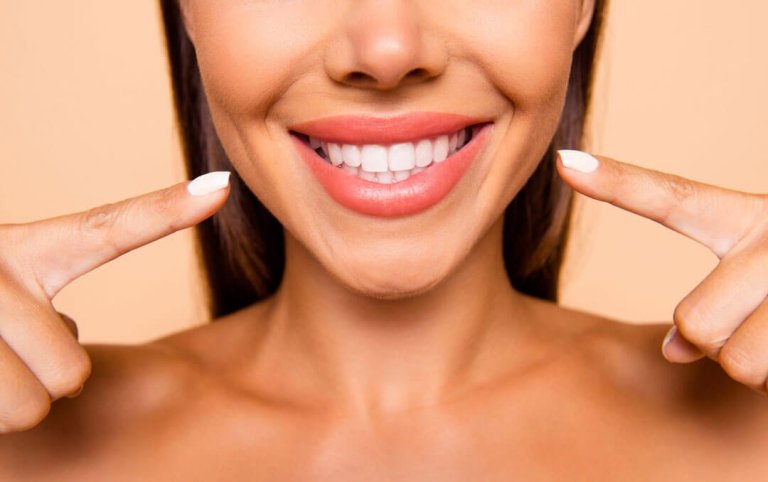 Unveiling Perfection: Veneers in Las Vegas – A Comprehensive Guide to Dazzling Smiles