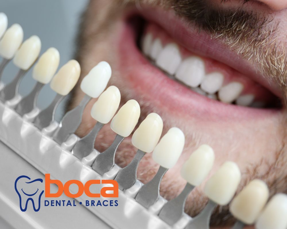 Comparing Veneers to Other Cosmetic Dental Solutions and Their Advantages for Your Smile